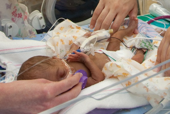 Premature baby in neonatal intensive care